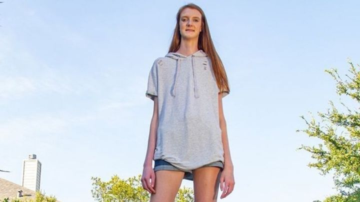 Con 17 años es la joven con las piernas más largas del mundo