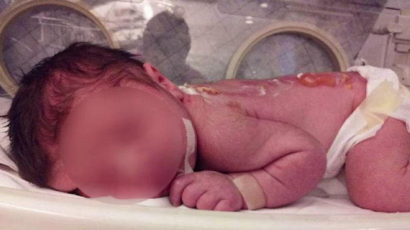 Desgarrador: falleció una beba recién nacida por Covid-19