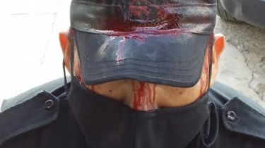 Le hundieron el cráneo a un policía por detener un partidito ilegal