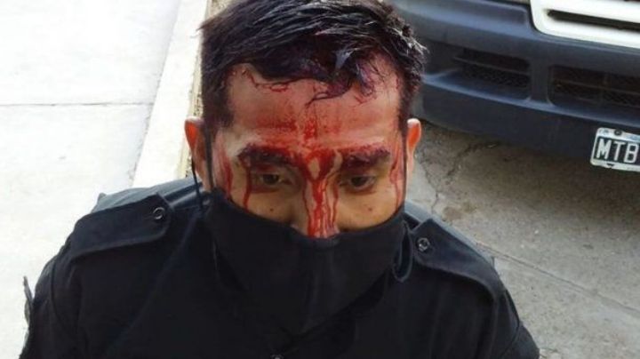 Le hundieron el cráneo a un policía por detener un partidito ilegal