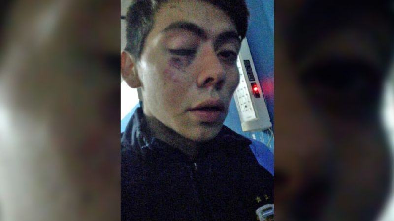 Otra vez la 23°: jugador de Villa Obrera relató una brutal paliza policial