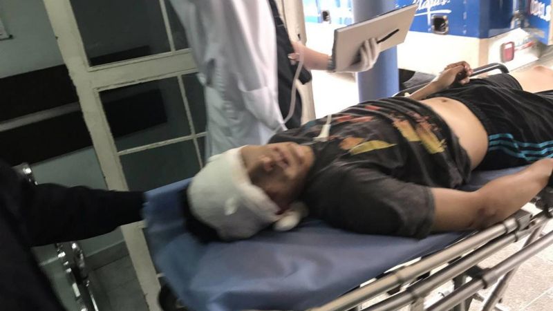 Un hombre sufrió un brutal intento de robo en Chimbas: le pegaron un fierrazo