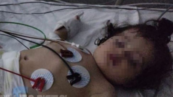 Una bebe de Caucete fue picada por un alacrán: ¿Cómo es su estado de salud?