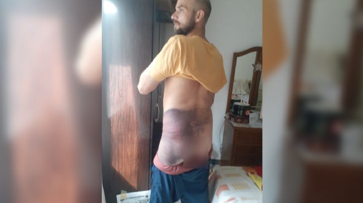 Residente cordobés denuncia brutal golpiza por policías de la Comisaría 6°