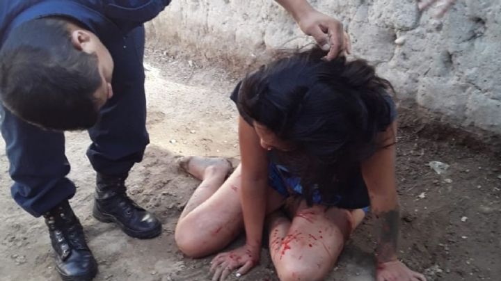Una mujer le dio una paliza a su hija en Chimbas