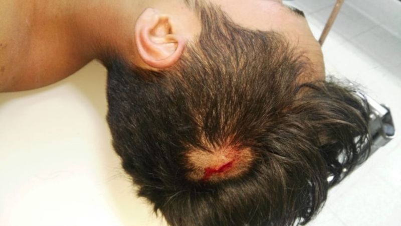 Un hombre le dio una paliza a su hermano ‘destrozándole’ la cabeza