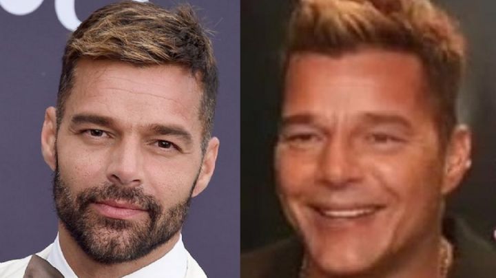 Ricky Martin posó con nueva cara y las redes estallaron