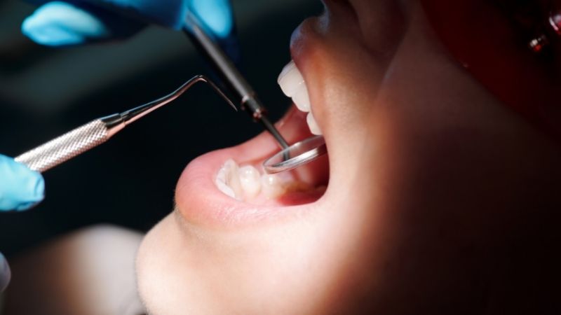 2 dentistas le sacaron 10 dientes sin razón a un niño: ¿qué castigo recibieron?
