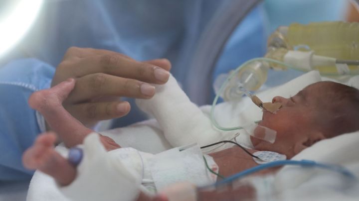 ¿Tenés un bebe prematuro? una especialista te cuenta debes saber para cuidarlo