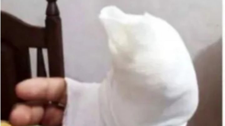 Un policía se enfrentó a los ladrones: le mordieron el dedo y se lo amputaron