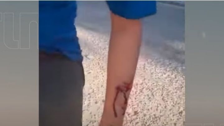 Impactante video: caminaba con su madre y fue brutalmente atacado por un pitbull