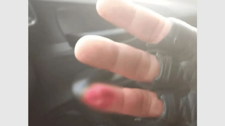 Borracho y caníbal: mordió a un policía y se tragó parte de su dedo
