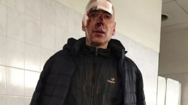 Brutal agresión a un corredor: 'Fueron a matarme'